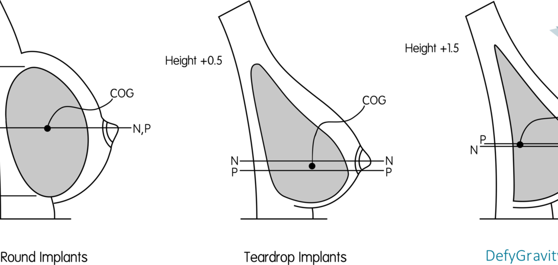 How To Get Teardrop Breasts