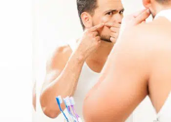 causes, solutions, and treatments for adult acne