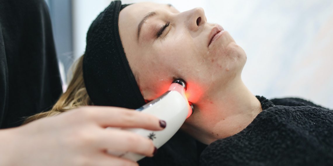 Benefits of Laser Skin Tightening for Your Skin